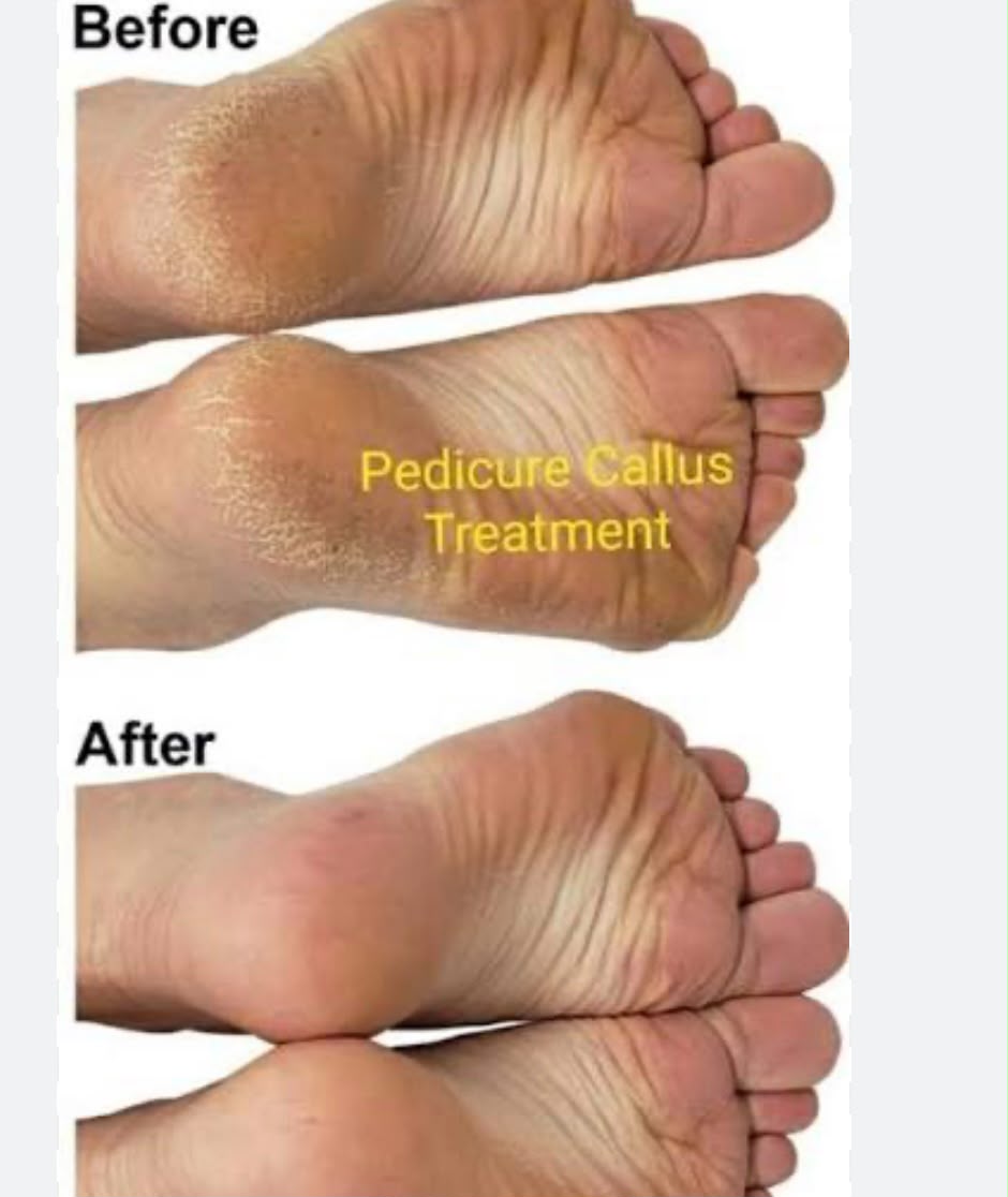 Spa-pedicure